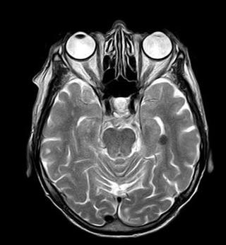 magnetic resonance CT